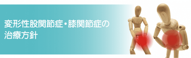 変形性股関節症・膝関節症の治療方針｜佐久市立国保浅間総合病院（佐久 